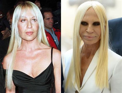 donatella versace paul|donatella versace before and after surgery.